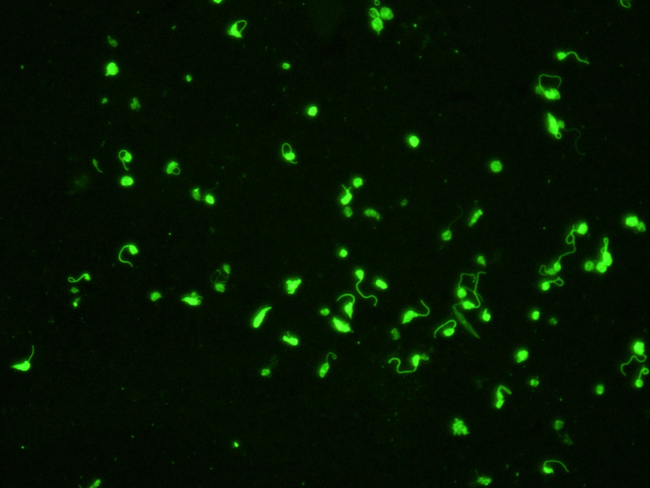 Promastigotes de Leishmania infantum (IFI)